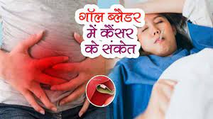 Photo of तेजी से बिहार बढ़ रहे मुंह, गला और गॉल ब्लाडर कैंसर के मरीज…