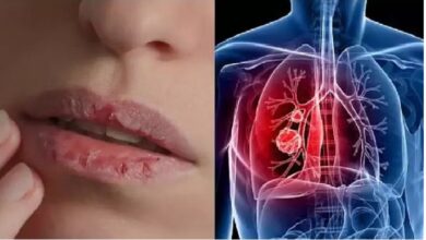 Photo of प्रदूषण से हो रहा निमोनिया…दो की मौत,पढ़े पूरी खबर