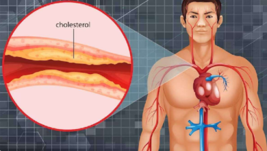 Photo of नसों में जमे गंदे कोलेस्ट्रॉल को कम करने के लिए रामबाण घरेलू उपाय