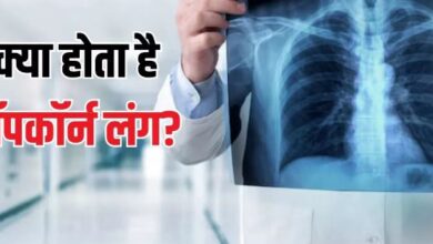 Photo of सिर्फ वेपिंग की वजह से ही होता है Popcorn Lung? जानें इसके लक्षण