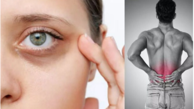 Photo of शरीर में दिखें ये 7 लक्षण तो समझ जाएं कम हो गया है Collagen