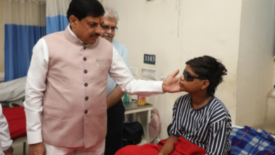 Photo of हमीदिया अस्पताल पहुँचे सीएम यादव: कार्बाइड गन से घायल बच्चों से मिले