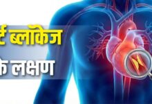 Photo of सीने में दर्द ही नहीं, ये 5 लक्षण भी हैं हार्ट ब्लॉकेज की निशानी
