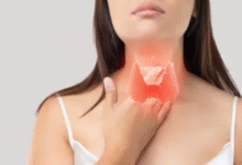 Photo of पुरुषों से ज्यादा महिलाओं में बढ़ रही है थायरॉइड की समस्या