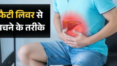 Photo of भारत में तेजी से पैर पसार रहा फैटी लिवर, रिसर्च में सामने आई बड़ी वजह