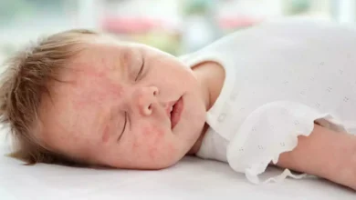 Photo of हम आपको कुक ऐसे टिप्स के बारे में बता रहें, जिनकी मदद से आप शिशुओं की स्किन ड्राई होने से बचा सकते हैं