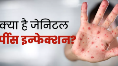 Photo of शरीर पर पानी भरे दाने हो सकते हैं जेनिटल हर्पीस के संकेत