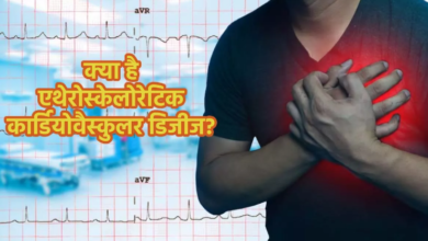 Photo of बैड कोलेस्ट्रॉल से बढ़ सकता है ASCVD का खतरा…