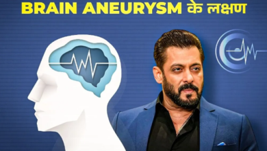 Photo of क्या है Brain Aneurysm, जिससे जूझ रहे हैं बॉलीवुड एक्‍टर Salman Khan