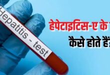 Photo of बारिश के मौसम में क्यों बढ़ जाता है हेपेटाइटिस-ए का खतरा?