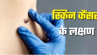 Photo of स्किन कैंसर का शुरुआती लक्षण है लंबे समय तक घाव का न भरना