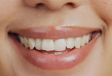 Photo of स्मोकिंग छोड़ने के बाद भी दांतों पर क्यों रह जाते हैं पीले दाग?